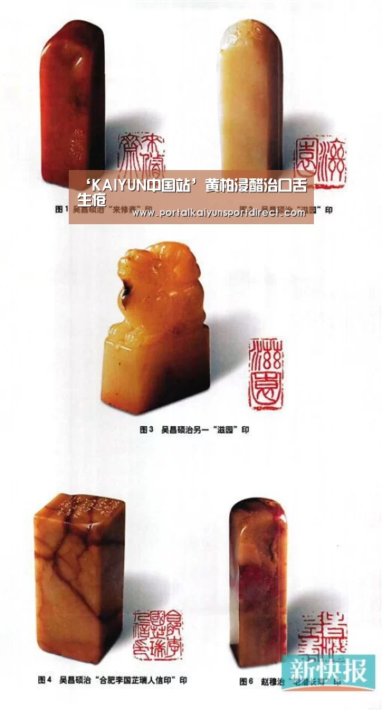 ‘KAIYUN中国站’黄柏浸醋治口舌生疮(图3) KAIYUN中国站